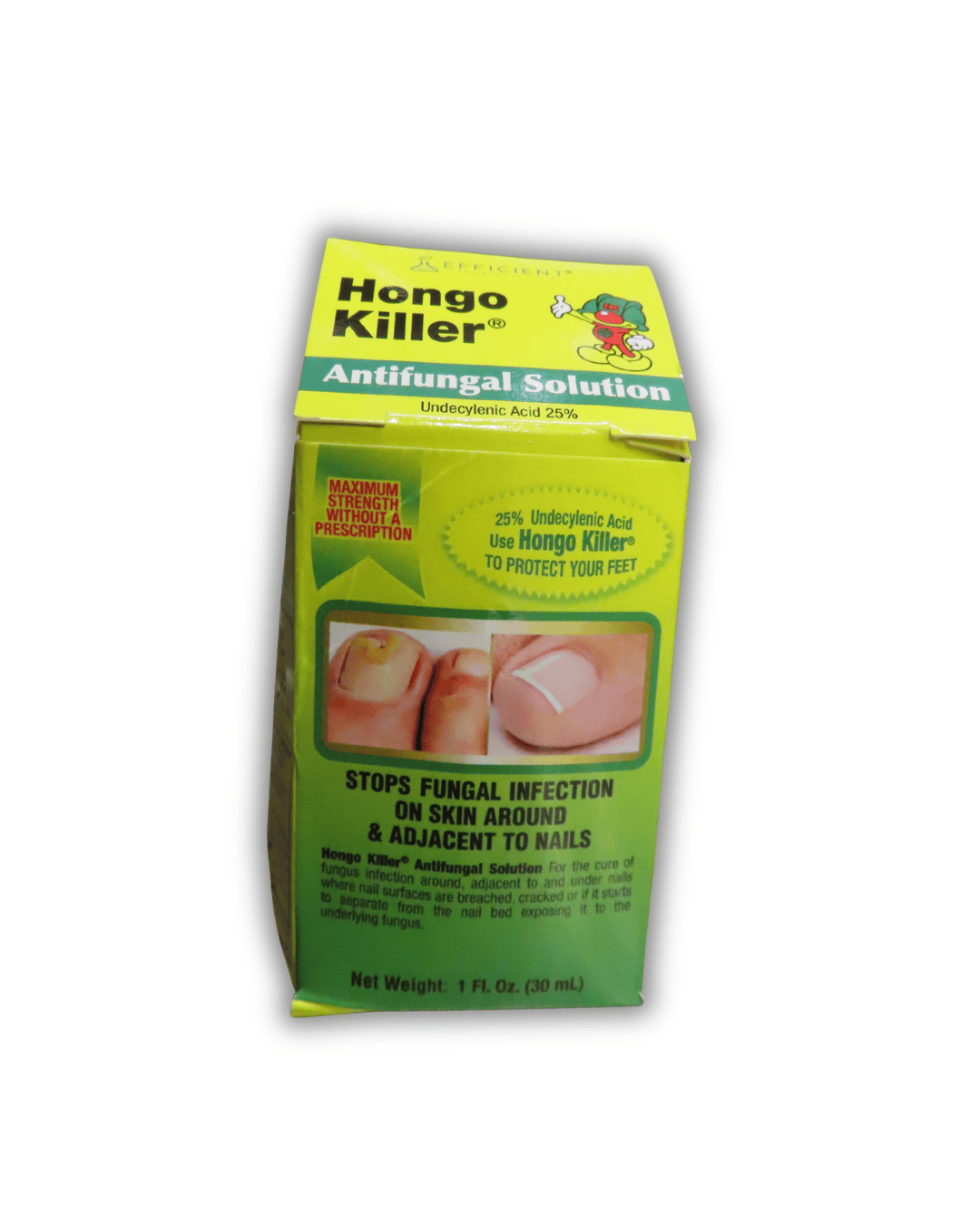 Hongo Killer Antifungal Solution 30ml - El Mercadito Salvadoreno